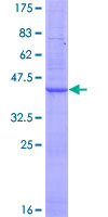 ORMDL3 Protein - 12.5% SDS-PAGE of human ORMDL3 stained with Coomassie Blue