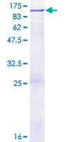 OS9 Protein - 12.5% SDS-PAGE of human OS9 stained with Coomassie Blue
