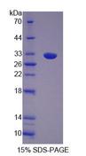 OS9 Protein - Recombinant Osteosarcoma Amplified 9 (OS9) by SDS-PAGE
