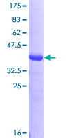 OSBP Protein - 12.5% SDS-PAGE Stained with Coomassie Blue