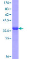 OSBP2 Protein - 12.5% SDS-PAGE Stained with Coomassie Blue.
