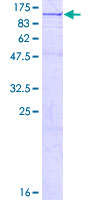 OSBPL11 Protein - 12.5% SDS-PAGE of human OSBPL11 stained with Coomassie Blue
