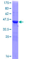 OSBPL1A / ORP1 Protein - 12.5% SDS-PAGE of human OSBPL1A stained with Coomassie Blue