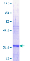OSBPL1A / ORP1 Protein - 12.5% SDS-PAGE Stained with Coomassie Blue.