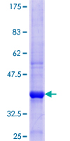 OSBPL2 Protein - 12.5% SDS-PAGE Stained with Coomassie Blue.