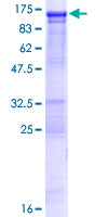 OSBPL3 Protein - 12.5% SDS-PAGE of human OSBPL3 stained with Coomassie Blue