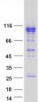 OSBPL5 Protein - Purified recombinant protein OSBPL5 was analyzed by SDS-PAGE gel and Coomassie Blue Staining