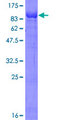 OSBPL6 Protein - 12.5% SDS-PAGE of human OSBPL6 stained with Coomassie Blue