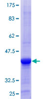 OSBPL6 Protein - 12.5% SDS-PAGE Stained with Coomassie Blue.
