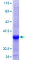 OSBPL6 Protein - 12.5% SDS-PAGE Stained with Coomassie Blue.