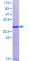 OSBPL7 Protein - 12.5% SDS-PAGE Stained with Coomassie Blue.