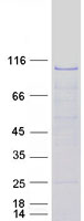 OSBPL7 Protein - Purified recombinant protein OSBPL7 was analyzed by SDS-PAGE gel and Coomassie Blue Staining