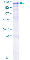 OSBPL8 Protein - 12.5% SDS-PAGE of human OSBPL8 stained with Coomassie Blue