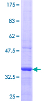 OSBPL8 Protein - 12.5% SDS-PAGE Stained with Coomassie Blue.