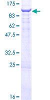 OSBPL9 Protein - 12.5% SDS-PAGE of human OSBPL9 stained with Coomassie Blue