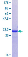 OSCAR Protein - 12.5% SDS-PAGE Stained with Coomassie Blue.