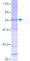 OSER1 / C20orf111 Protein - 12.5% SDS-PAGE of human C20orf111 stained with Coomassie Blue