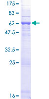 OSGEP Protein - 12.5% SDS-PAGE of human OSGEP stained with Coomassie Blue