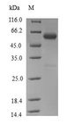 OSGEP Protein - (Tris-Glycine gel) Discontinuous SDS-PAGE (reduced) with 5% enrichment gel and 15% separation gel.
