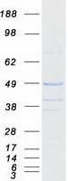 OSGEP Protein - Purified recombinant protein OSGEP was analyzed by SDS-PAGE gel and Coomassie Blue Staining
