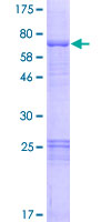 OSGEPL1 Protein - 12.5% SDS-PAGE of human OSGEPL1 stained with Coomassie Blue