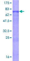 OSGIN1 Protein - 12.5% SDS-PAGE of human OKL38 stained with Coomassie Blue