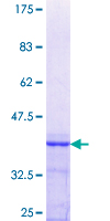 OSGIN1 Protein - 12.5% SDS-PAGE Stained with Coomassie Blue.