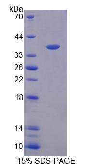OSGIN1 Protein - Recombinant  Oxidative Stress Induced Growth Inhibitor 1 By SDS-PAGE