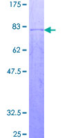 OSGIN2 Protein - 12.5% SDS-PAGE of human C8orf1 stained with Coomassie Blue
