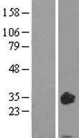 OSM / Oncostatin M Protein - Western validation with an anti-DDK antibody * L: Control HEK293 lysate R: Over-expression lysate