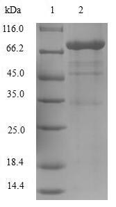 OSM / Oncostatin M Protein - (Tris-Glycine gel) Discontinuous SDS-PAGE (reduced) with 5% enrichment gel and 15% separation gel.