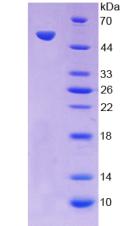 OSM / Oncostatin M Protein - Recombinant Oncostatin M By SDS-PAGE