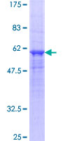 OSMR / IL-31R-Beta Protein - 12.5% SDS-PAGE of human OSMR stained with Coomassie Blue