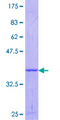 OSMR / IL-31R-Beta Protein - 12.5% SDS-PAGE Stained with Coomassie Blue.