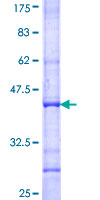 OSR1 Protein - 12.5% SDS-PAGE Stained with Coomassie Blue.