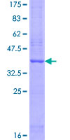 OSTC Protein - 12.5% SDS-PAGE of human DC2 stained with Coomassie Blue