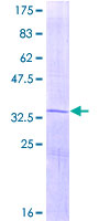 Osteocalcin Protein - 12.5% SDS-PAGE of human BGLAP stained with Coomassie Blue
