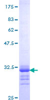 Osteocalcin Protein - 12.5% SDS-PAGE Stained with Coomassie Blue.
