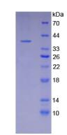 Osteocalcin Protein - Recombinant Osteocalcin By SDS-PAGE
