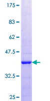 Osteoglycin / Mimecan Protein - 12.5% SDS-PAGE Stained with Coomassie Blue