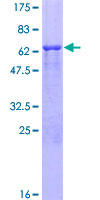 Osteonectin / SPARC Protein - 12.5% SDS-PAGE of human SPARC stained with Coomassie Blue