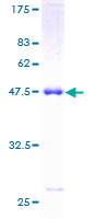OSTF1 / OSF Protein - 12.5% SDS-PAGE of human OSTF1 stained with Coomassie Blue