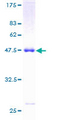OSTF1 / OSF Protein - 12.5% SDS-PAGE of human OSTF1 stained with Coomassie Blue