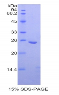 OSTF1 / OSF Protein - Recombinant Osteoclast Stimulating Factor 1 By SDS-PAGE