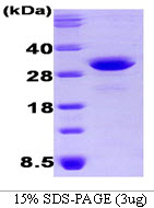 OSTF1 / OSF Protein