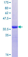 OSTM1 Protein - 12.5% SDS-PAGE Stained with Coomassie Blue.