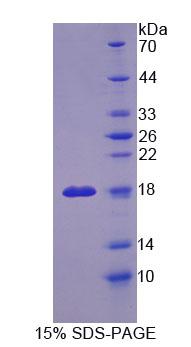 OSTM1 Protein - Recombinant Osteopetrosis Associated Transmembrane Protein 1 (OSTM1) by SDS-PAGE