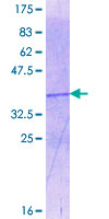 OTC Protein - 12.5% SDS-PAGE Stained with Coomassie Blue