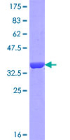 OTOA Protein - 12.5% SDS-PAGE Stained with Coomassie Blue.