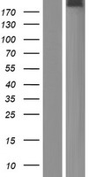OTOGL Protein - Western validation with an anti-DDK antibody * L: Control HEK293 lysate R: Over-expression lysate